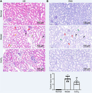 Histopathological analysis after treatment. (A) H&E staining depicting kidney features. Model group exhibited erythrocyte stasis (red arrow), epithelial cell shedding (green arrow), bare basement membrane (black arrow), and renal tubular cell flattening due to dilation (orange arrows). CoCl2 group showed lesser damage than CIN group. (B) Periodic acid-Schiff staining: magnification, 400×. * indicateds model vs. normal, # indicates CoCl2 vs. model; n = 9; **,## p < 0.01.