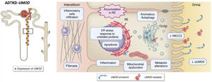 Schematic diagram of the pathophysiology of UMOD alterations. On the left, the restricted expression of UMOD to the ascending branch of Henle and the first sections of the distal convoluted tubule is depicted. On the right, the altered processes due to expression of mutant UMOD. Source: adapted from Mabillard et al. (2023).7 NKCC2: sodium–potassium–chlorine cotransporter (Na+–K+–2Cl–); ER: endoplasmic reticulum; uUMOD: UMOD in urine; UPR: unfolded protein response.