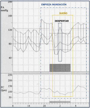 Recording of our patient