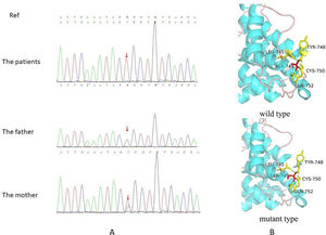 (A) The result of sequencing of the families (the ORCL variant was marked with red arrow). (B) The protein three-dimensional structure (the amino acid change was marked with red color).