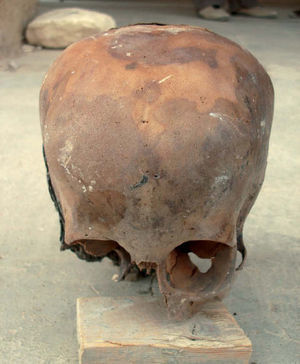 Vista anterior del cráneo.