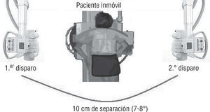 Método de obtención de una radiografía estereoscópica.