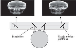 Esquema de observación por estereoscopio.