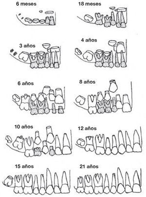 Cronología de la erupción dentaria, tabla de dentición10.