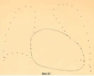 Ejemplo de ortodiagrama (Francke K. Die Orthodiagraphie. Ein Lehrbuch für Aertze. München: JF Lehmann