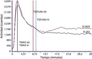 Curva renográfica basal normal. Curvas renográficas de patrón normal para ambos riñones. El tiempo al pico de las curvas (TMAX) y el T50%Mx de la fase de eliminación se encuentran dentro de los límites de la normalidad.