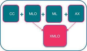 Protocolo de seguimiento tras cirugía conservadora: proyección XMLO en sustitución de las proyecciones MLO y AX.