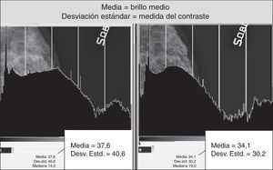 Los histogramas comparativos del mismo mamograma con diferentes variaciones del valor de S presentan una leve variación de distribución de los grises medianos, conservando la misma amplitud de la escala de grises.