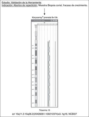 Ejemplo representativo de la validación de Karyoarray®prenatal 8x15K.