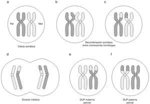 Formación (poscigótica) de disomía uniparental (DUP) parcial o segmentaria (adaptado de Gardner et al.10).