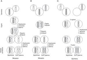Posibles mecanismos de formación de mosaicismo con una línea celular biparental y otra con DUP del genoma paterno. Cada cromosoma de la figura equivale al genoma haploide materno (rayado) o paterno (punteado) (adaptado de Morales et al.22).