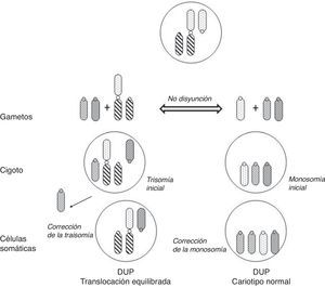 Mecanismos de formación de DUP en la descendencia de portadores de translocación robertsoniana equilibrada (adaptado de Kim et al.33).