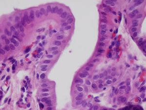 Appearance of the completely re-epithelialized bile duct, with the same thickness of the native tissue.