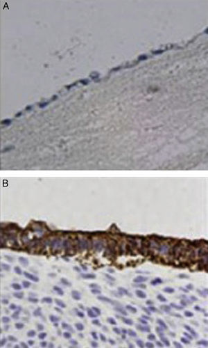 Immunohistochemistry: positive reaction against epithelial membrane antibody (A) and low molecular weight keratin antibody (B) in transplanted animals.