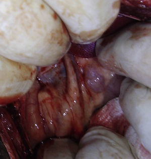 Bile duct of the pig.