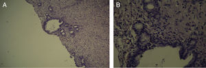 Biopsies of the second centimeter of the bile duct, without contact with the tube for 60 days; (A) low magnification and (B) high magnification.