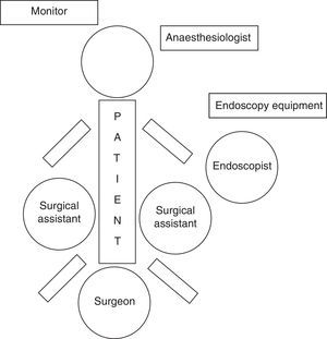 Diagram showing the placement of the surgical and endoscopic equipment and team for correct completion of the procedure.