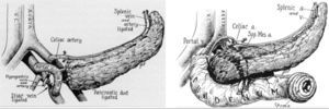 Transplantation models in the first 2 cases of R. Lillehei.