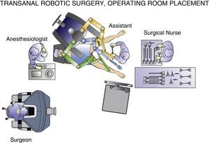 Transanal robotic surgery, operating room placement.
