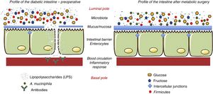 Hypothesis about the mechanisms of action that explain the effects of metabolic surgery associated with the microbiota. Metabolic surgery changes the disposition of food in the gastrointestinal tract. In turn, these changes alter the bacterial flora or microbiota. The main change is the reduction of lipopolysaccharide-producing Firmicutes. When lipopolysaccharides decrease, the inflammatory response associated with diabetes decreases. Similarly, the hyperplasia-hypertrophy of the intestinal epithelium after surgery and the presence of A. muciniphila improve the integrity of the intestinal barrier function. Adapted from Cani et al.36 through Servier Medical Art by Creative Commons Attribution 3.0.