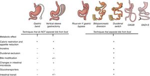 Main mechanisms that explain the control of blood glucose levels in different bariatric surgery techniques. All the techniques have a mechanical restrictive effect that leads to decreased appetite and caloric intake. Until now, the metabolic effect was mainly attributed to the incretin effect that, with the exception of the gastric band, is observed in all the techniques. However, the diversion techniques, in addition to all the above, also modify the intestinal structure and convert the intestine into a system that consumes glucose from the blood. For this reason, excluding the duodenum and separating the bile from food achieves a greater reduction in blood glucose.