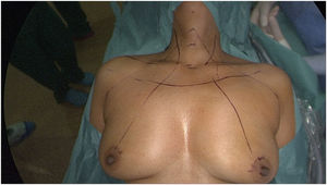 Placement of the patient and anatomic reference points.