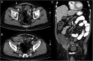 Fig. 1