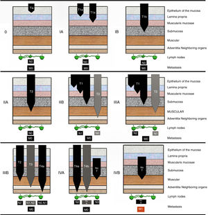 pTNM stages of adenocarcinoma of the esophagus and EGJ.
