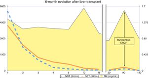Postoperative evolution for 6 months after liver transplantation: the ordinate axis on the right represents transaminases in IU/mL, and the axis on the left represents bilirubin in mg/mL. The abscissa axis represents the post-transplant time in days.