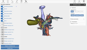 3D modelling options panel, which provides 360° movement around the tumor and adjacent structures as well as the possibility to modify and adapt the parameters and movement of the 3D image.
