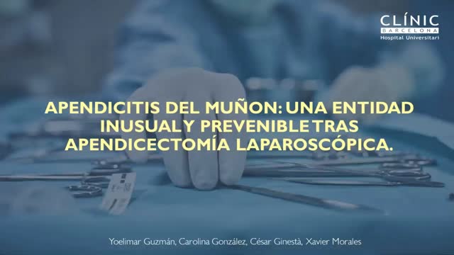 https://ars.els-cdn.com/content/image/1-s2.0-S2173507721002362-mmc1.mp4