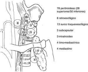 Anatomical location of the single and double adenomas that have not been located preoperatively.