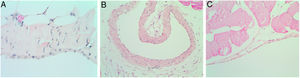 Microscopic findings on the parietal peritoneum. A (control group-B): Hematoxylin and eosin 400×; B (hyperthermic group-C): hematoxylin and eosin 200×; C (hot air group-D): hematoxylin and eosin 200×. Lesions were not observed in the peritoneal mesothelium.