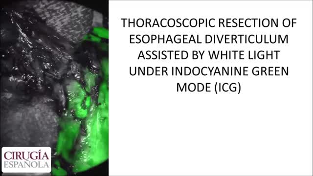 https://ars.els-cdn.com/content/image/1-s2.0-S2173507722001314-mmc1.mp4