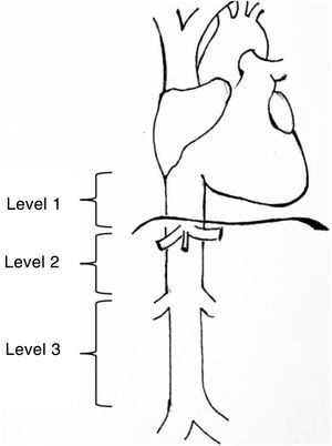 Levels of involvement according to the classification by Kulaylat et al.4.