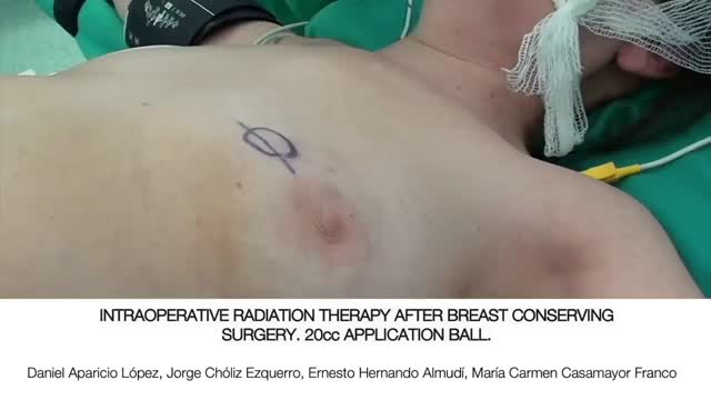 https://ars.els-cdn.com/content/image/1-s2.0-S2173507722002915-mmc1.mp4