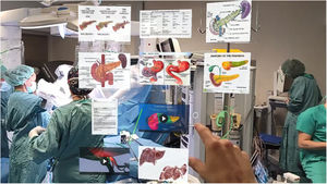 Teaching support. Tables, figures, diagrams, videos and virtual 3D models as support tools for medical school training.