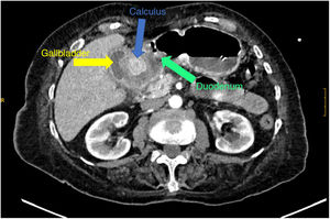 Fig. 1