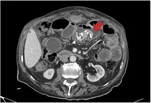 Fig. 1
