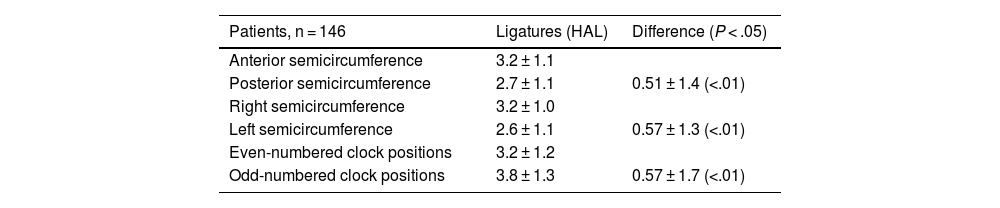 Tables