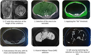 Axia CT slices to measure abdominal fat distribution.