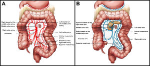 Diagram of the surgical anatomy of the colon. (A) Arterial and (B) Venous.
