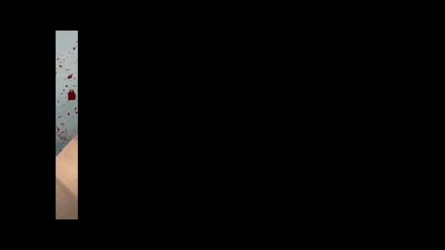 https://ars.els-cdn.com/content/image/1-s2.0-S2173507725000018-mmc1.mp4