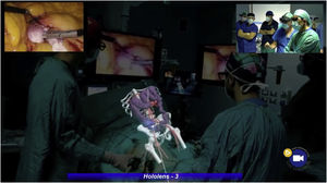 Hologram superimposed on the patient in the operation room.