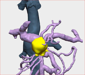 Detail of the venous vascularisation in the 3D study. https://www.cellams.com.