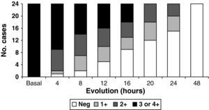 Ketonuria values: frequency histogram of the patients with resolved DKA according to the ketonuria values in the course of 48h.