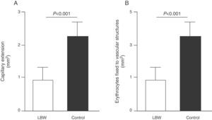 Effect of low birth weight (LBW) on endothelial proliferation properties of endothelial colony-forming cells (ECFCs) present in umbilical cord blood. As shown, cultured ECFC colonies from infants with LBW showed a reduced capacity to form tubular and capillary structures (A), less proliferation capacity, and less angiogenic potential (B). Taken and modified from Ligi I, et al. Blood. 2011;118:1699–709.