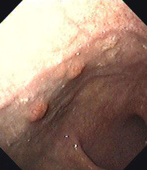 Pre-treatment lesions in patient number 1.