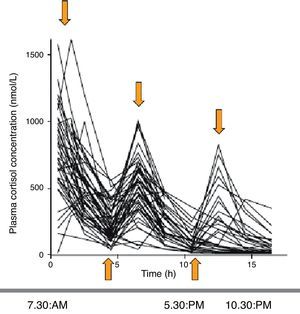 Serum cortisol profiles over the day in patients with AI treated with hydrocortisone (short half-life) as 2–3 doses daily. Supraphysiological peaks and infraphysiological nadirs are found. Source: Simon et al.5.