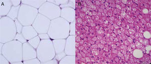 Light microscope image of white adipose tissue (A) and brown adipose tissue (B).